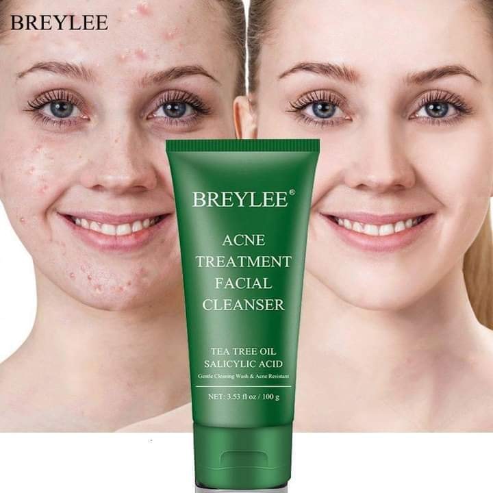 Breylee acne treatment Facial cleanser (100g)
