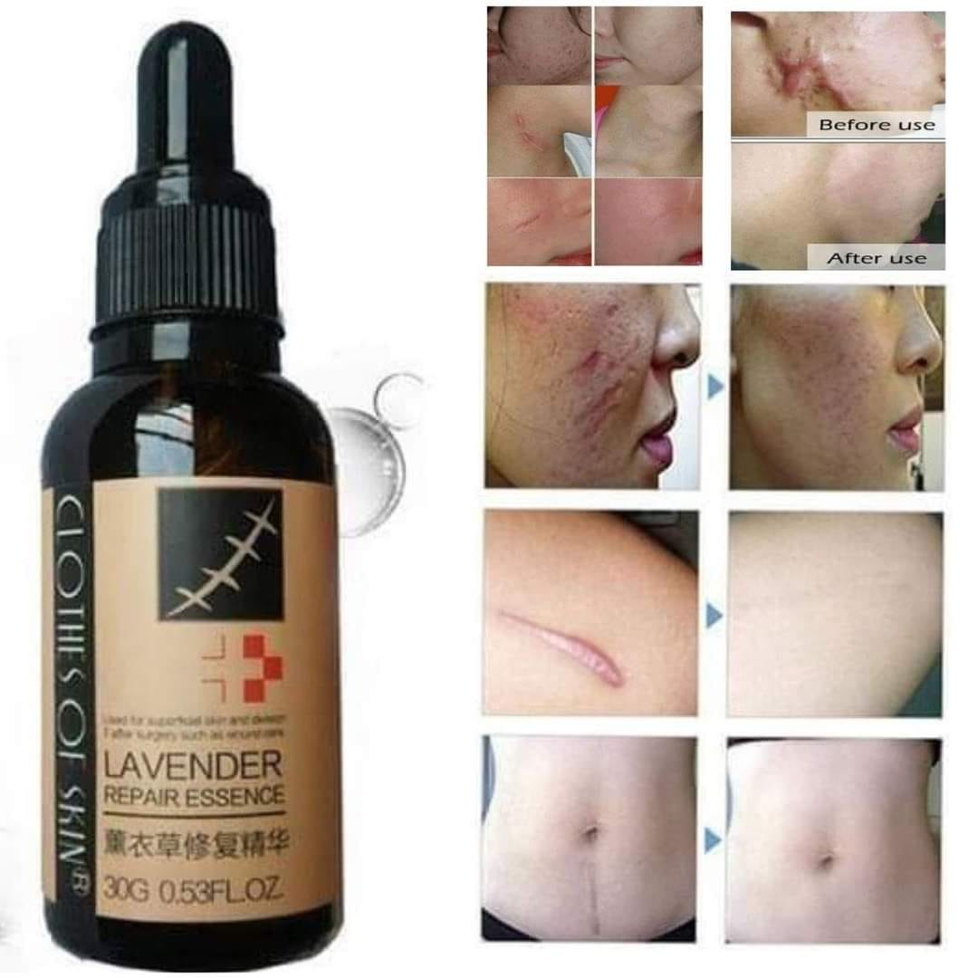 Lavender Scar Repair Skin Essential Oil