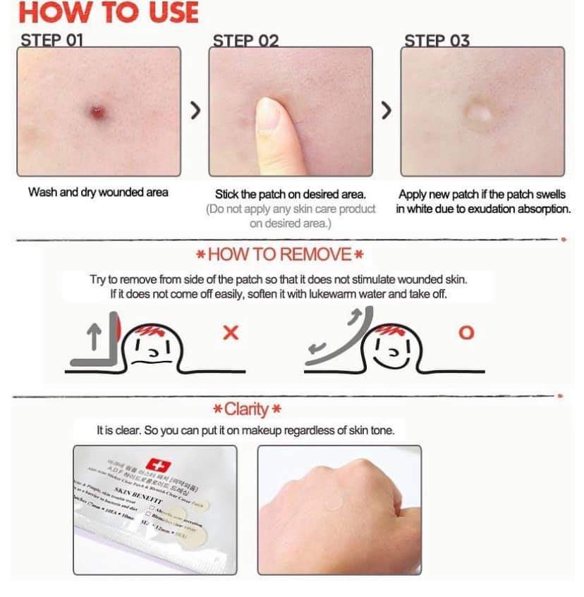 𝗖𝗢𝗦𝗥𝗫 𝗔𝗰𝗻𝗲 𝗣𝗶𝗺𝗽𝗹𝗲 𝗠𝗮𝘀𝘁𝗲𝗿 𝗣𝗮𝘁𝗰𝗵 𝟮𝟰 𝗣𝗮𝘁𝗰𝗵𝗲𝘀